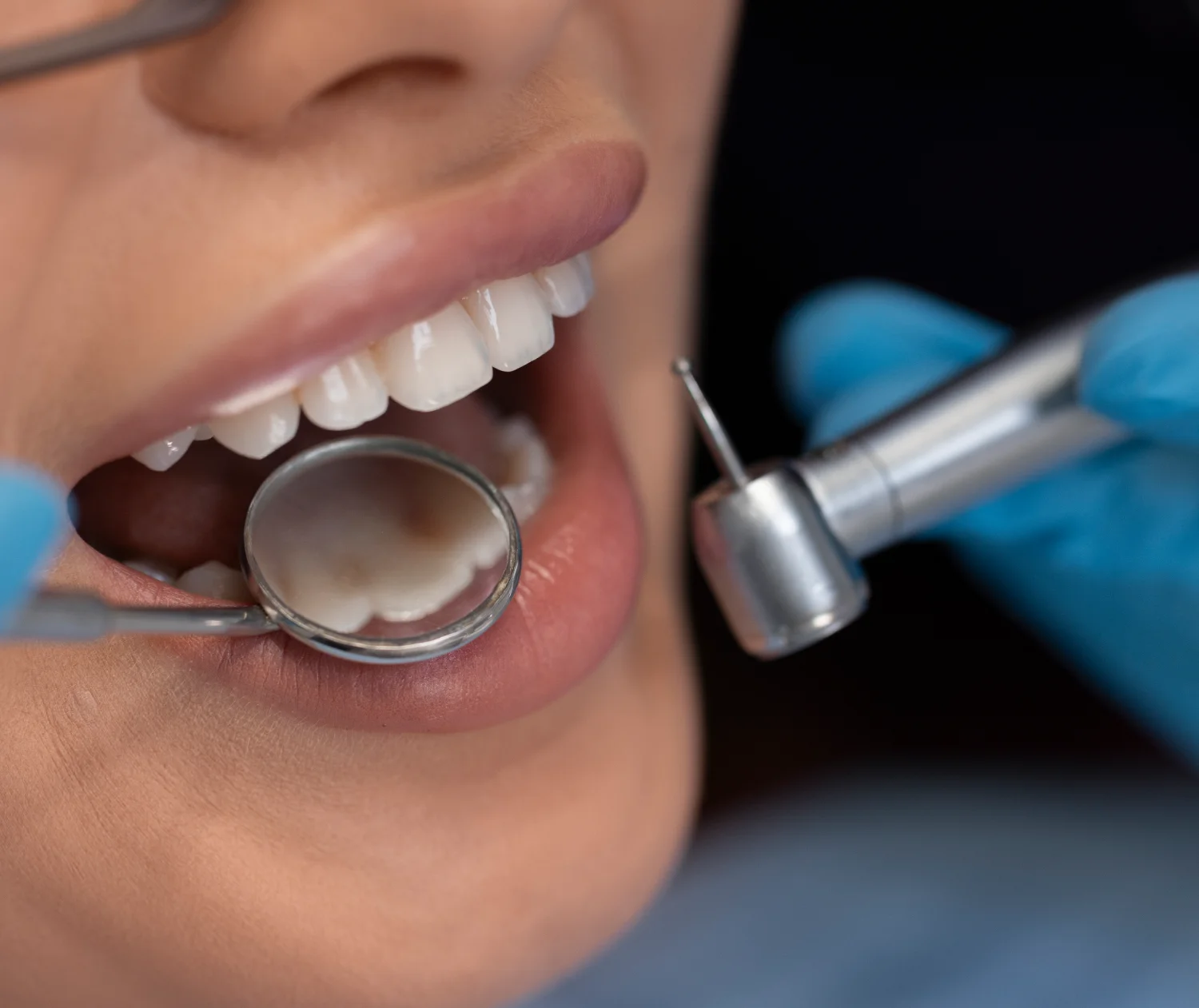 Imagem de destaque de Odontologia Estética