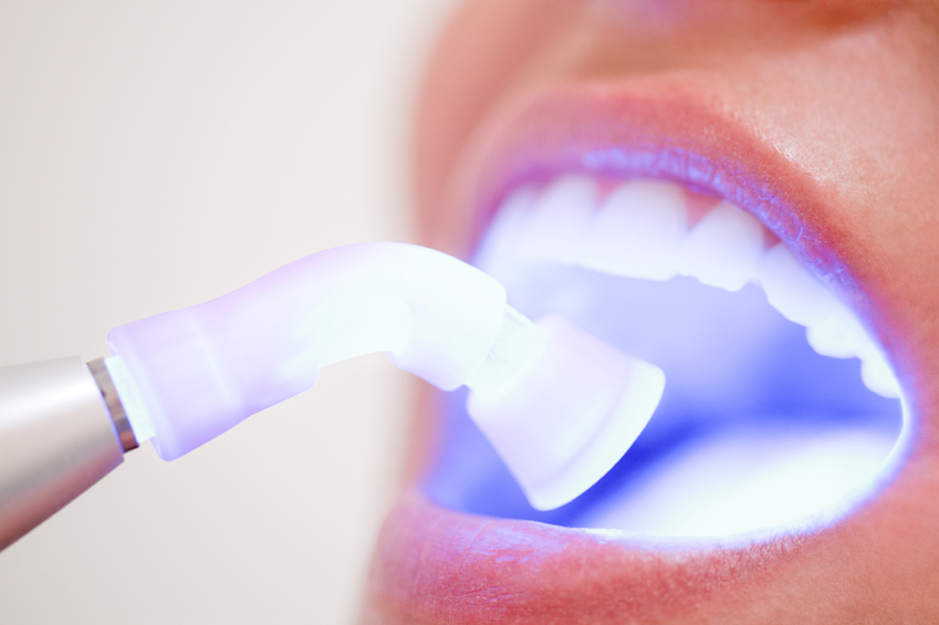 5 serviços da Odontologia Estética